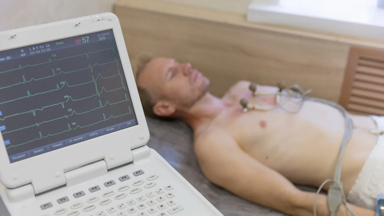 A patient lying down with ECG leads attached while the tracing shows on a monitor